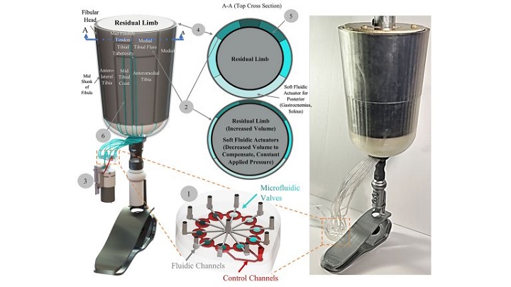 Proof-of-concept rendering (left) and photo (right) of the prototype microfluidics-enabled prosthesis. Source: University of Waterloo