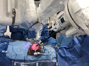 Cleveland Clinic surgeons perform the world’s first robotic single port kidney transplant. Source: Cleveland Clinic