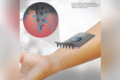 A microneedle patch was combined with a paper sensor to painlessly monitor blood glucose levels. Source: University of Tokyo
