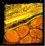 Photomicrograph of periosteum (upper diagonol). Credit: Prof. Melissa Knothe Tate, UNSW