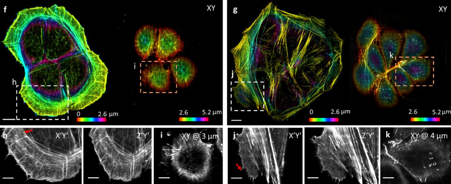 The images obtained by the combination of the new coverslip and computer algorithms show clearer views of small structures. (Yicong Wu, National Institute of Biomedical Imaging and Bioengineering)