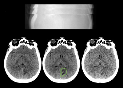 Sample X-ray projection images through a patient&rsquo;s head are used to reconstruct CT images of the patient&rsquo;s brain. Source: Mayo Clinic