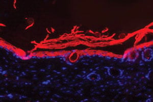 An immunofluorescence image shows regenerated dermal tissue (in pink) in wounds treated with the bandage. Image source: Northwestern University/ McCormick School of Engineering