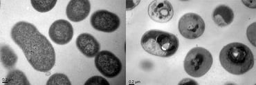 Normal cells of the Acinetobacter baumannii bacteria before (left) and after (right) treatment with the polymers. Source: Agency for Science, Technology and Research (A*STAR), Singapore 