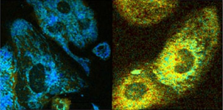 Optical readouts of HL-1 cardiomyocytes in response to chemical uncoupling by CCCP. Redox ratio map for control (left), and CCCP exposed cardiomyocytes (right). (Source: Irene Georgakoudi/Tufts University)