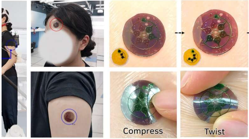 Example of the fabricated patch worn (left) and images of sequential sweat collection and storage (right). By designing precise microfluidic channels based on capillary burst valves, sequential sweat collection was implemented, which enabled label-free analysis of metabolite changes associated with exercise and diet. Source: Nature Communications (2025). DOI: 10.1038/s41467-025-63510-2