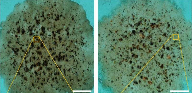 Using AI to detect parasites in stool samples | GlobalSpec