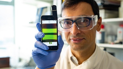 The smartphone-based microfluidic system quantifies E. coli in urine in less than 25 minutes. Source: University of Bath
