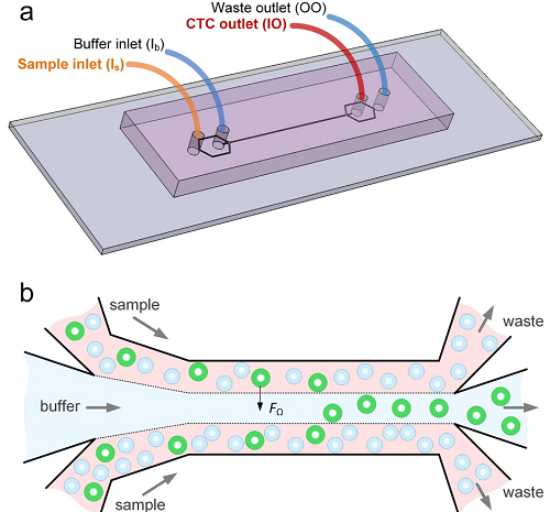 a) Configuration of the inlets and outlets. b) Diagram depicts how the microfluidics device separates cancer cells (green circles) from blood. Source: Ian Papautsky, University of Illinois Chicago