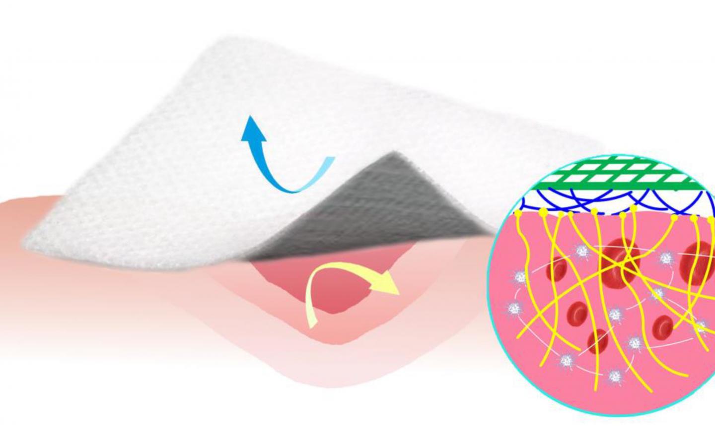 Promotes healing and can subsequently be easliy removed: a new kind of bandage coated with silicone and carbon nanofibers. Source: Li Z et al. Nature Communications 2019