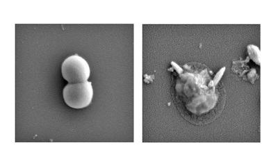 Golden Staph bacteria before (left) and after (right) exposure to the magnetic liquid metal nanoparticles. In the images, magnified 70,000 times, sharp pieces of liquid metal particle can be seen physically disrupting the bacteria after treatment. Source: RMIT
