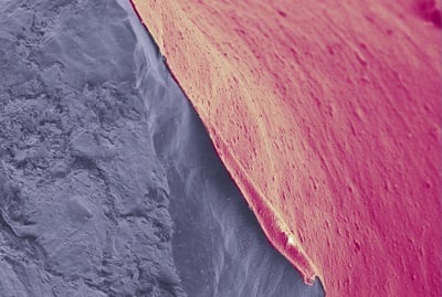 Scanning electron microscope image of nanoporous polymer-coated Li. Source: Monash University