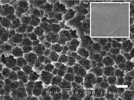 Scanning electron microscope image of PET film degraded by  201-F6 bacterium (inset shows intact film). Image source: Yoshida et al.