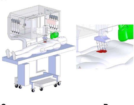 Schematic demonstrating scale, design and components of the skin bioprinter. Source: Wake Forest Institute for Regenerative Medicine 