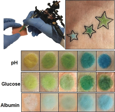 The colorimetric tattoos were injected into pig skin patches. Source: Wiley-VCH