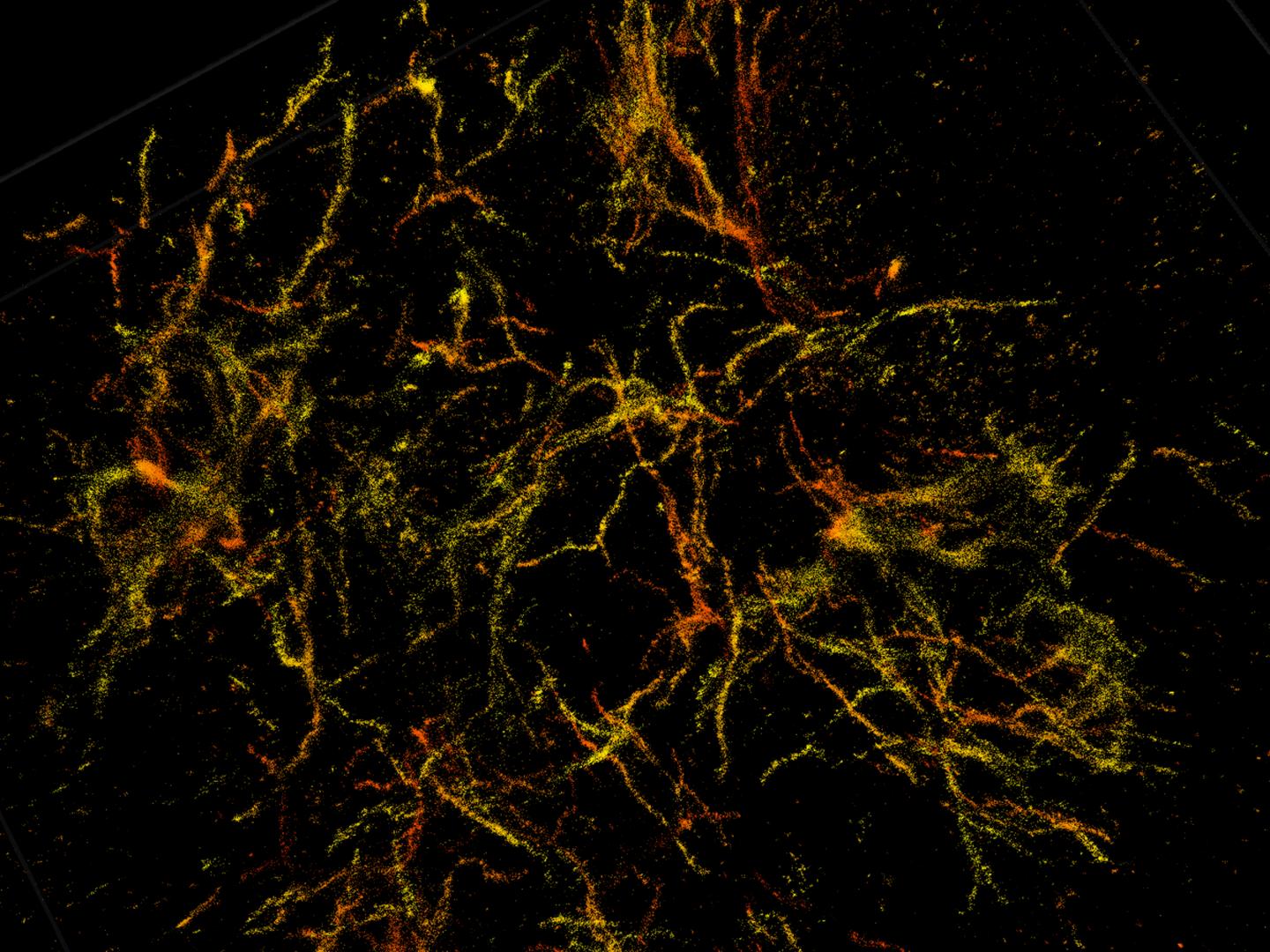 Purdue researchers have taken 3D single molecule super-resolution images of the amyloid plaques associated with Alzheimer's disease in 30-micron thick sections of the mouse's frontal cortex. Source: Purdue University / Fenil Patel