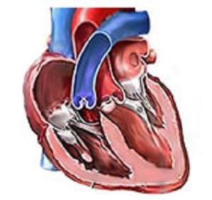 A featured data set in the uCI Machine Learning Repository offers cardiac Single Proton Emission Computed Tomography (SPECT) images. Source: UCI