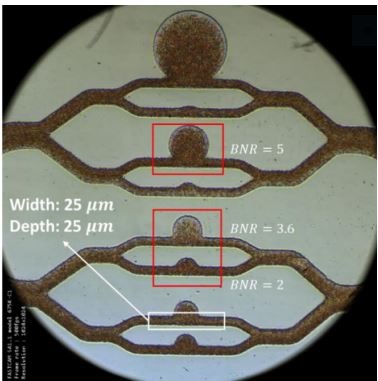 A microscopic image of the microaneurysm-on-a-chip. Source: Subra Suresh et al.