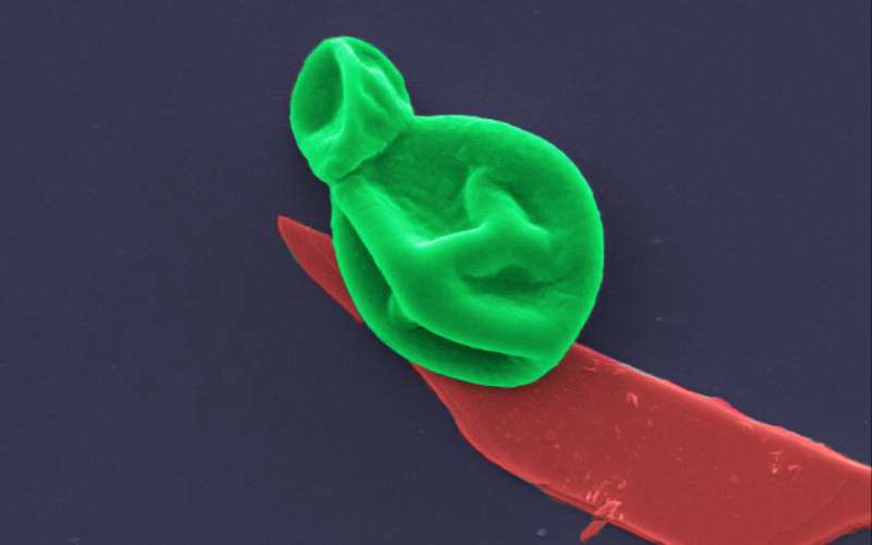 Magnified image of a fungal cell (green) interacting with a nanothin layer of black phosphorous (red). Source: RMIT University