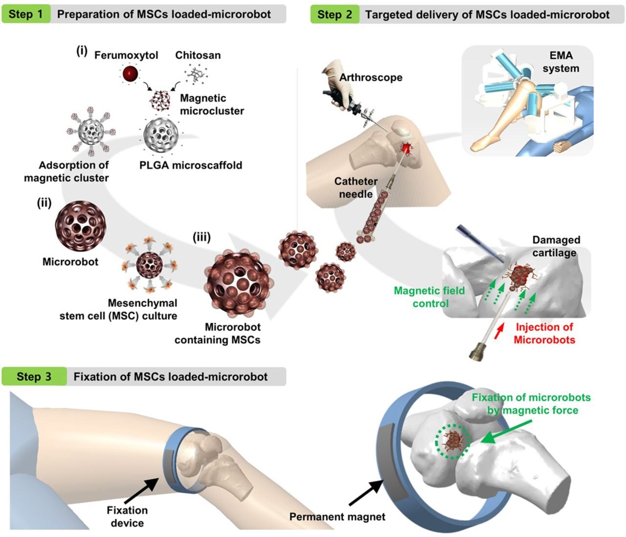 Concept overview of knee cartilage regeneration procedures using magnetic microrobot-mediated MSC delivery system. The magnetic microrobot containing MSCs was prepared through a sequential process by adsorption of magnetic microclusters on the PLGA microscaffold and MSCs loading (step 1). The prepared MSC-loaded microrobots were delivered to cartilage defect using EMA system (step 2). After the targeted delivery procedure, the microrobots are immobilized to the defect using a permanent magnet (step 3).Source: Science Robotics (2020). DOI: 10.1126/scirobotics.aay6626