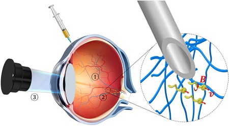 Schematic of the targeted delivery procedure used for the slippery micropropellers. Source: Science Advances