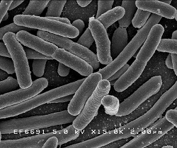 Escherichia coli. Source: Rocky Mountain Laboratories, NIAID, NIH