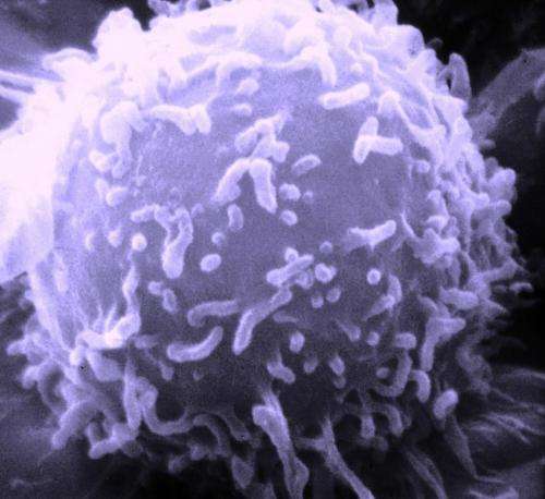 Electron microscopic image of a single human lymphocyte. Source: Dr. Triche National Cancer Institute