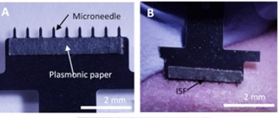 On the left, a close-up view of the skin patch shows nine tiny needles that collect interstitial fluid (ISF), which is attracted to the special paper on the patch. On the right, a microneedle patch is inserted into a rat’s skin to produce microscopic holes for ISF to flow through. Source: American Chemical Society, 2019