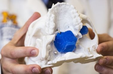 A 3D model guided surgery on a patient&rsquo;s skull.  Image source: University of Michigan Health Lab.