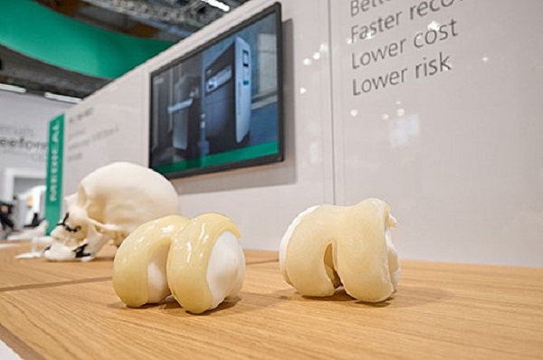 The Freeformer is suitable for new application ideas in medical technology. These include the "iKnee" - a patient-specific implant based on medical TPU that can be inserted into the knee as a minimally invasive cartilage replacement. Source: ARBURG
