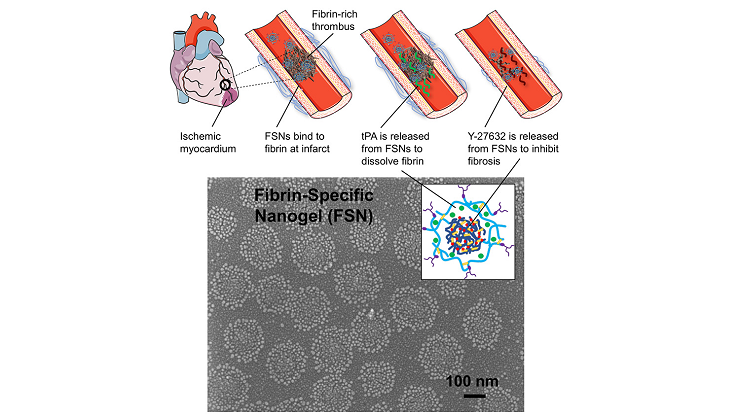 The nanospheres target a clot and deliver a cocktail of two drugs. Source: North Carolina State University