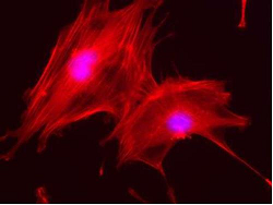 Osteoblast cells of a mouse growing on 3-D matrices and developed from agri-food industry waste. Source: Milagros Ramos, &Aacute;ngeles Mart&iacute;n, Malcolm Yates and Violeta Zurdo (CTB-UPM y CSIC)