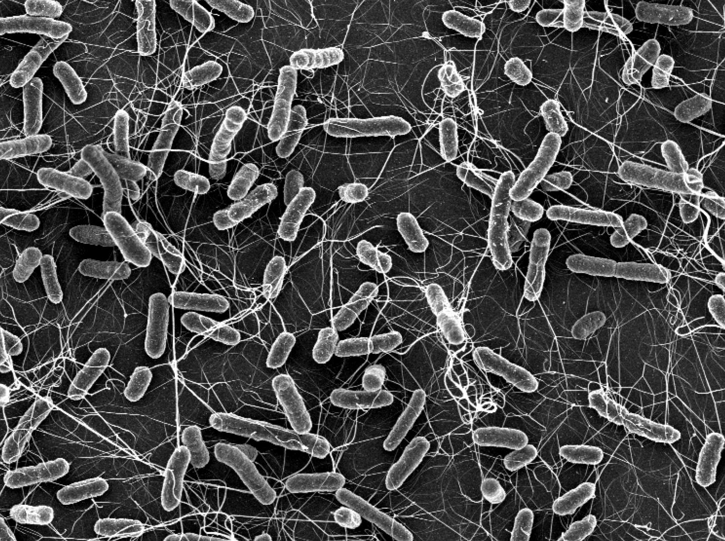 Salmonella causes diarrhea in animals and humans. These bacteria become a particular public health concern if they are resistant to antibiotics (electron microscopic photograph). Source: ETH Zurich / Stefan Fattinger