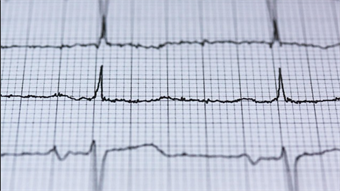 New tech identifies women at risk of heart disease using AI