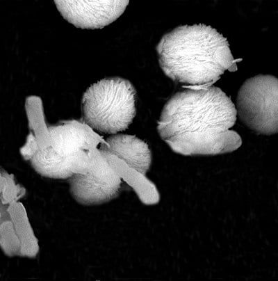 Electron microscope image shows E. coli bacteria trapped by wrapped microspheres. Source: Deyi Li/Tongji University