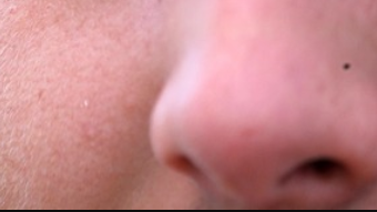 From nose to knees: Cartilage breakthrough promises to enhance joint treatment