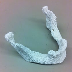 A 3d printed scaffold for a lower jaw implant. Image source: Johns Hopkins University