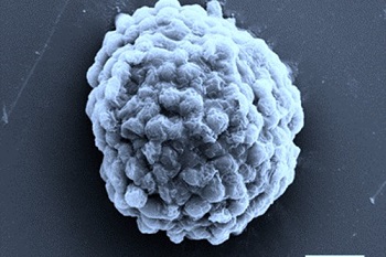 Electron microscopy image of a densely packed droplet of hydrogen-producing algal cells.  Source: Xin Huang et al.
