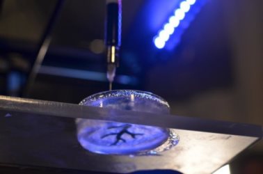Coronary artery structure being 3D bioprinted. Credit: Carnegie Mellon
