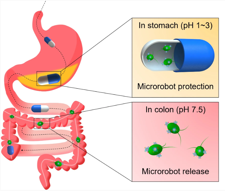 Algae-derived robots promise to treat IBD without drugs | GlobalSpec