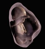 3-D virtual model MRI view of fetus at 26 weeks. Credit: Image courtesy of RSNA