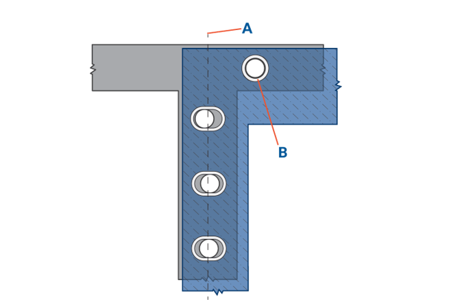 Figure 3: SPIROL&rsquo;s Oval Compression Limiters compensate for misalignment by providing an extra 2.25 mm of clearance on one axis B = Round Compression Limiter used as a homing fastening point. Source: SPIROL
