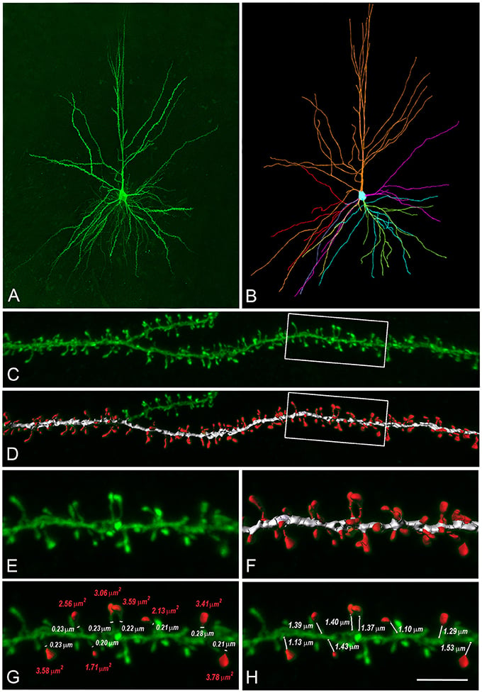 Researchers reconstructed digital models of human layer 3 (L3) dendritic spines. (A), (C) and (E) are confocal microscopy images of an actual human L3 pyramidal neuron. (B), (D) and (F) show the digital reconstructions. (G) and (H) display manual measurements of neural neck diameters and spine head areas. Source: Eyal, Verhoog, Testa-Silva, Deitcher, Benavides-Piccione, DeFelipe, de Kock, Mansvelder and Segev. (Click image to enlarge.)