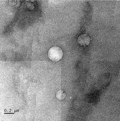 Low-salinity brine injected into crude oil forms nanoscale droplets that help separate oil from reservoir rock. The black ring around the droplets is asphaltene. Source: Wenhua Guo/Rice University
