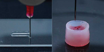The new carrier ink can be used to produce personalized implants such as heart valves. Source: Guzzi et al.