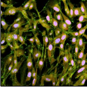 MSCs cell sheet grown on a transferable polymeric matrix. Image source: Wyss Institute at Harvard University