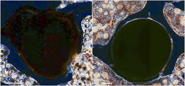 A histologic cell image (left) of the Purdue-developed metal pins in-vivo in which the metal is being resorbed by surrounding tissue. On the right: conventional metal pins that are not effectively resorbed by the body. Image credit: Marine Traverson and Gert Breur/Purdue College of Veterinary Medicine