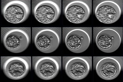 The embryos are classified as good (top), fair (middle) and poor quality (bottom). Source: Weill Cornell Medicine of Cornell University