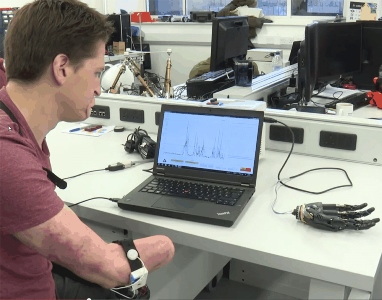 Sensors detect mechanical signals from vibrations produced when muscles flex. Image credit: Imperial College London.