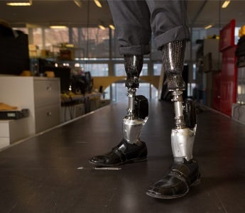 Just Like Real: Advances in Prosthetic Limbs | GlobalSpec